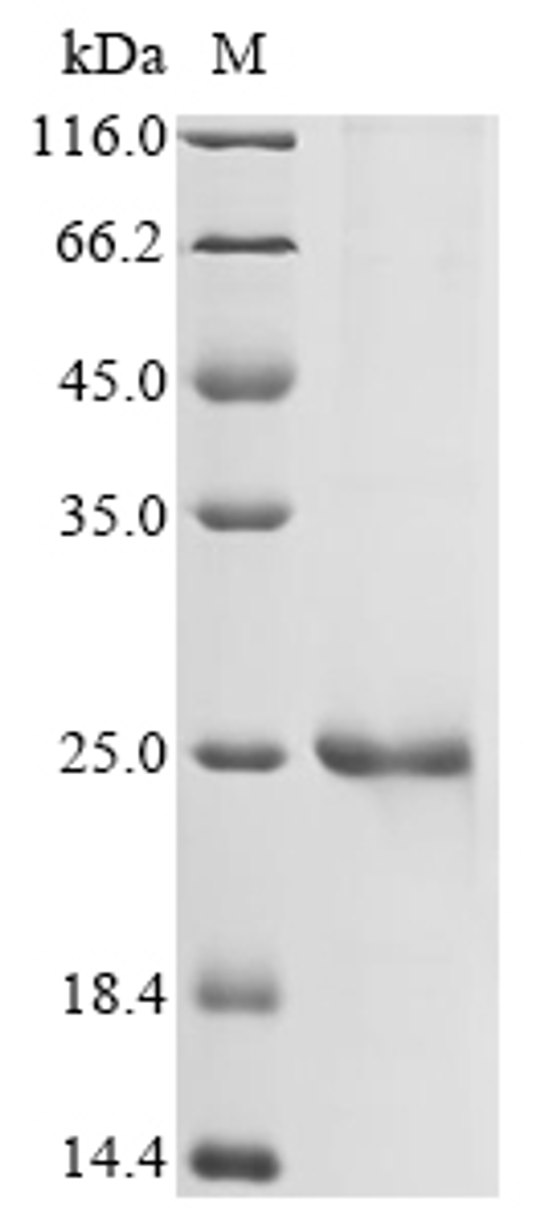 (Tris-Glycine gel) Discontinuous SDS-PAGE (reduced) with 5% enrichment gel and 15% separation gel.