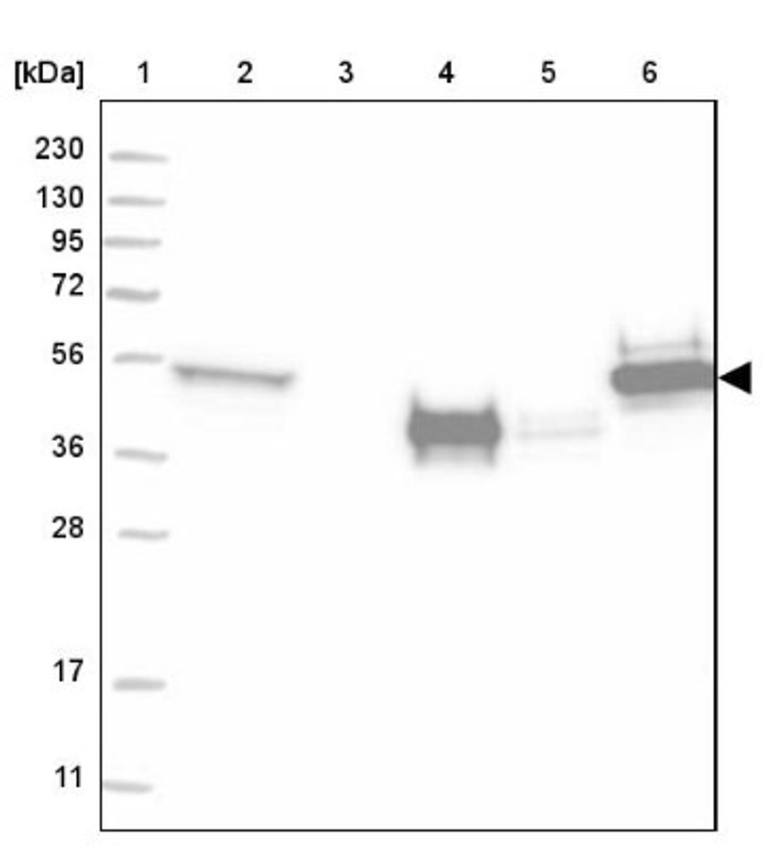 Western Blot: Cytokeratin 13 Antibody [NBP2-38166] - Lane 1: Marker [kDa] 230, 130, 95, 72, 56, 36, 28, 17, 11<br/>Lane 2: RT-4<br/>Lane 3: U-251 MG<br/>Lane 4: Human Plasma<br/>Lane 5: Liver<br/>Lane 6: Tonsil