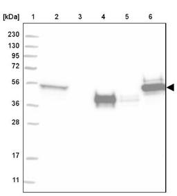 Western Blot: Cytokeratin 13 Antibody [NBP2-38166] - Lane 1: Marker [kDa] 230, 130, 95, 72, 56, 36, 28, 17, 11<br/>Lane 2: RT-4<br/>Lane 3: U-251 MG<br/>Lane 4: Human Plasma<br/>Lane 5: Liver<br/>Lane 6: Tonsil