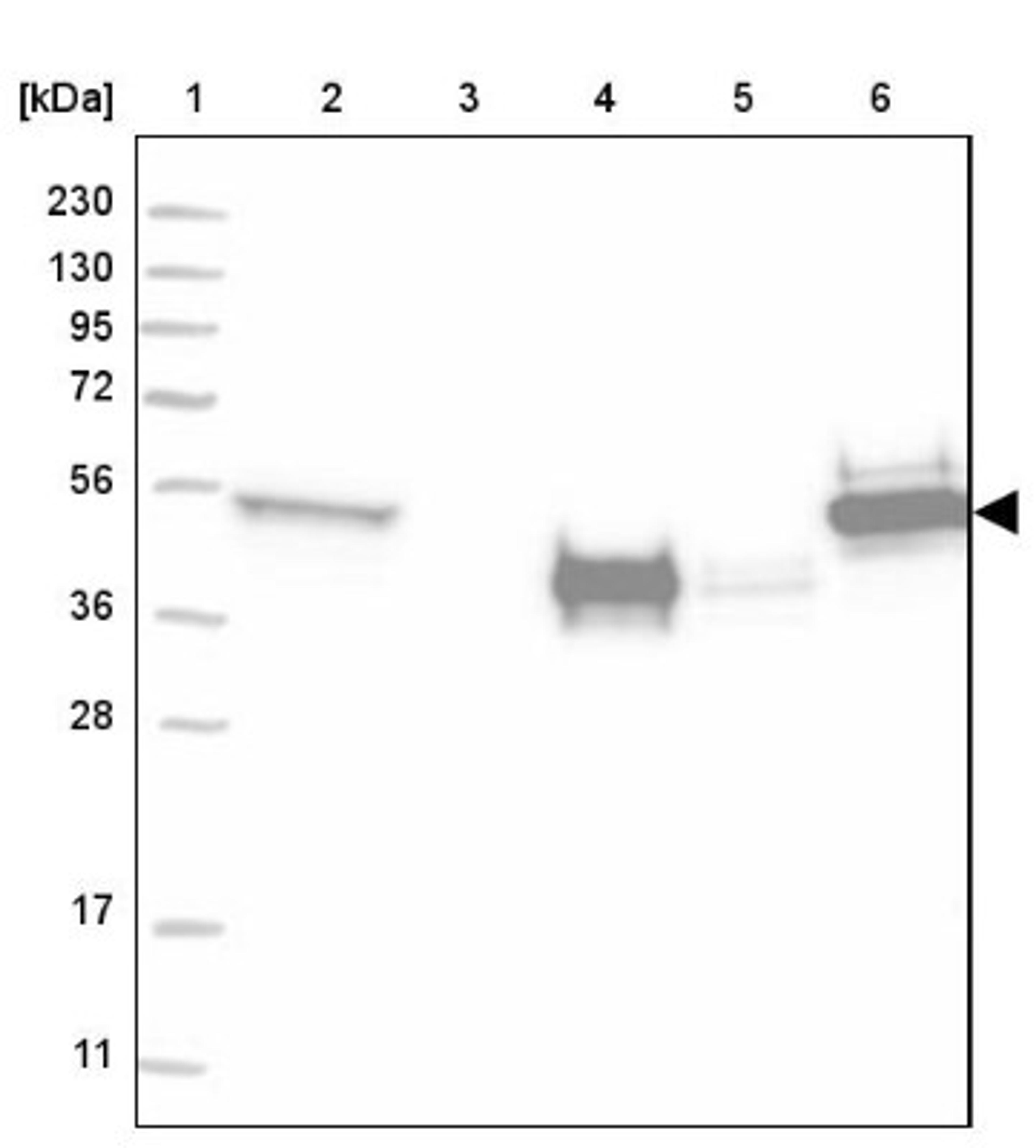 Western Blot: Cytokeratin 13 Antibody [NBP2-38166] - Lane 1: Marker [kDa] 230, 130, 95, 72, 56, 36, 28, 17, 11<br/>Lane 2: RT-4<br/>Lane 3: U-251 MG<br/>Lane 4: Human Plasma<br/>Lane 5: Liver<br/>Lane 6: Tonsil