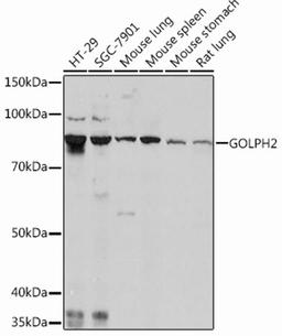 Western blot - GOLPH2 Rabbit mAb (A11538)