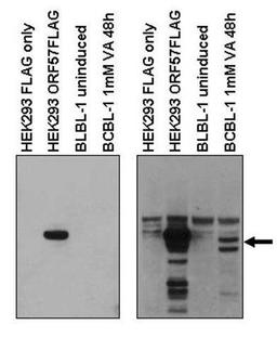 Western blot analysis of HEK293 cells transfected with ORF57 expression vector and ORF57 truncations, or in KSHV infected B-cell line using KSHV ORF57 antibody