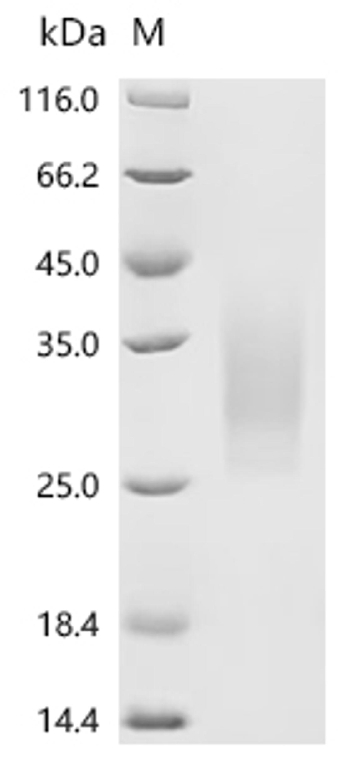 (Tris-Glycine gel) Discontinuous SDS-PAGE (reduced) with 5% enrichment gel and 15% separation gel.