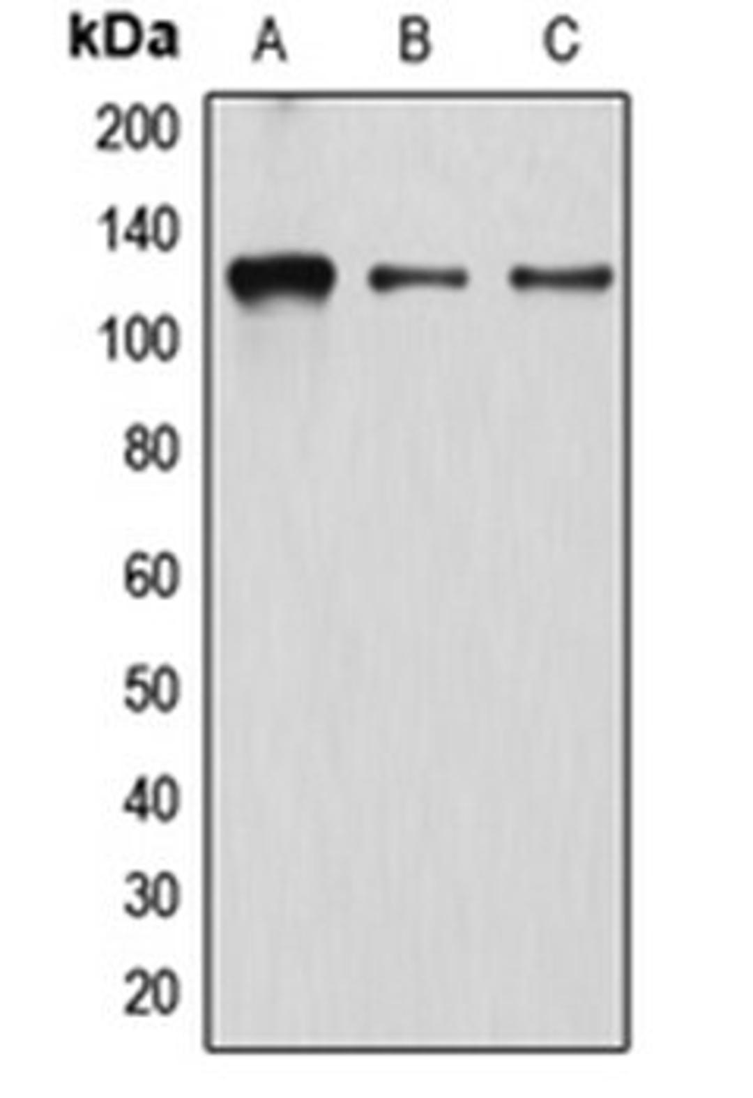 Western blot analysis of K562 (Lane 1), EOC20 (Lane 2), HeLa (Lane 3) whole cell lysates using ATN1 antibody