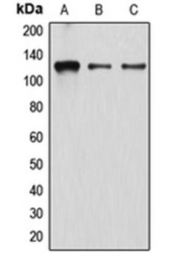 Western blot analysis of K562 (Lane 1), EOC20 (Lane 2), HeLa (Lane 3) whole cell lysates using ATN1 antibody