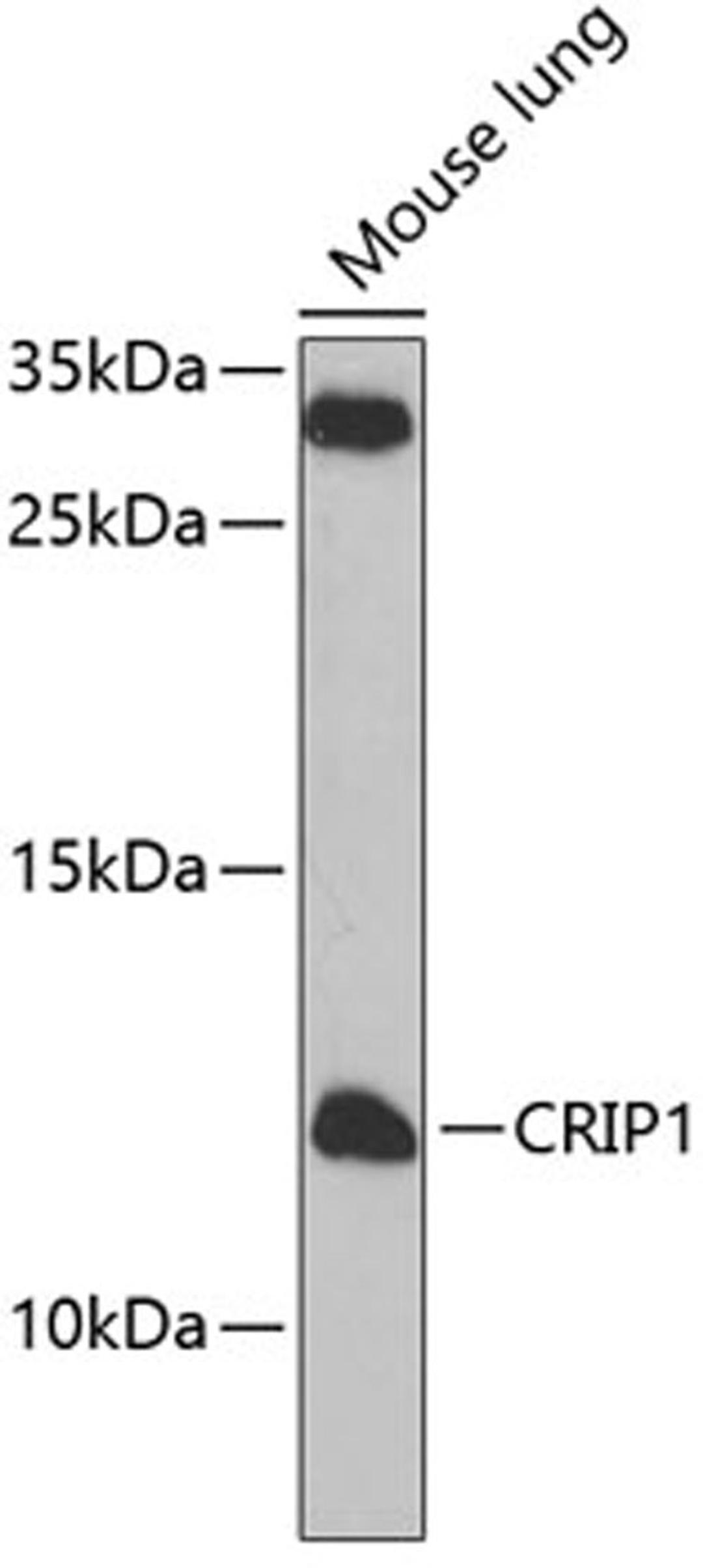 Western blot - CRIP1 antibody (A7548)