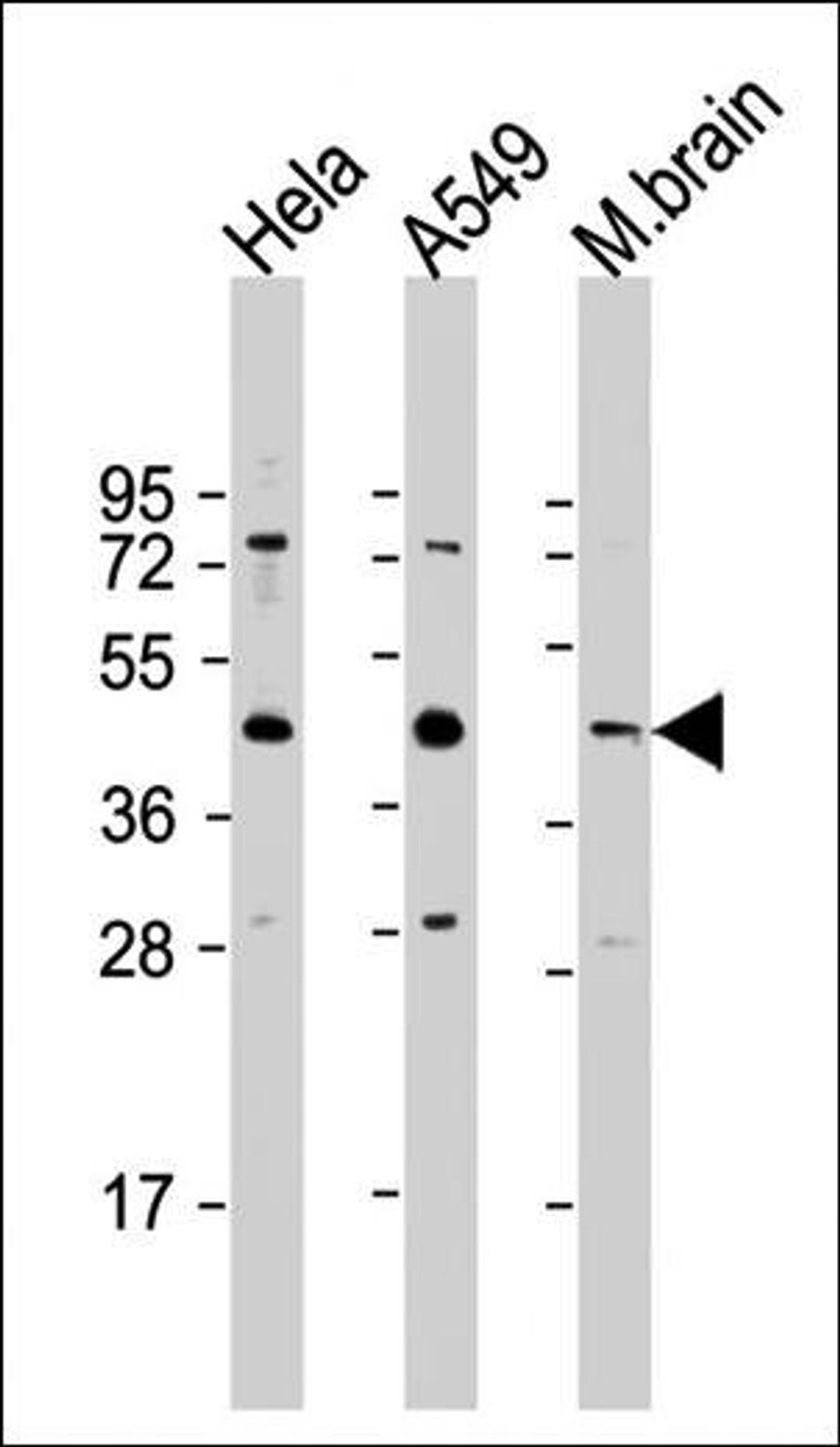 Western blot analysis of (Lane1) Hela whole cell lysate (Lane2) A549 whole cell lysate (Lane3) mouse brain lysate using G6PC3 antibody