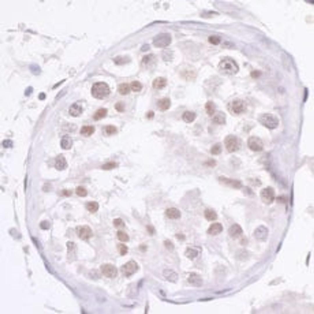 Detection of human NCOA2/ SRC2 by immunohistochemistry.