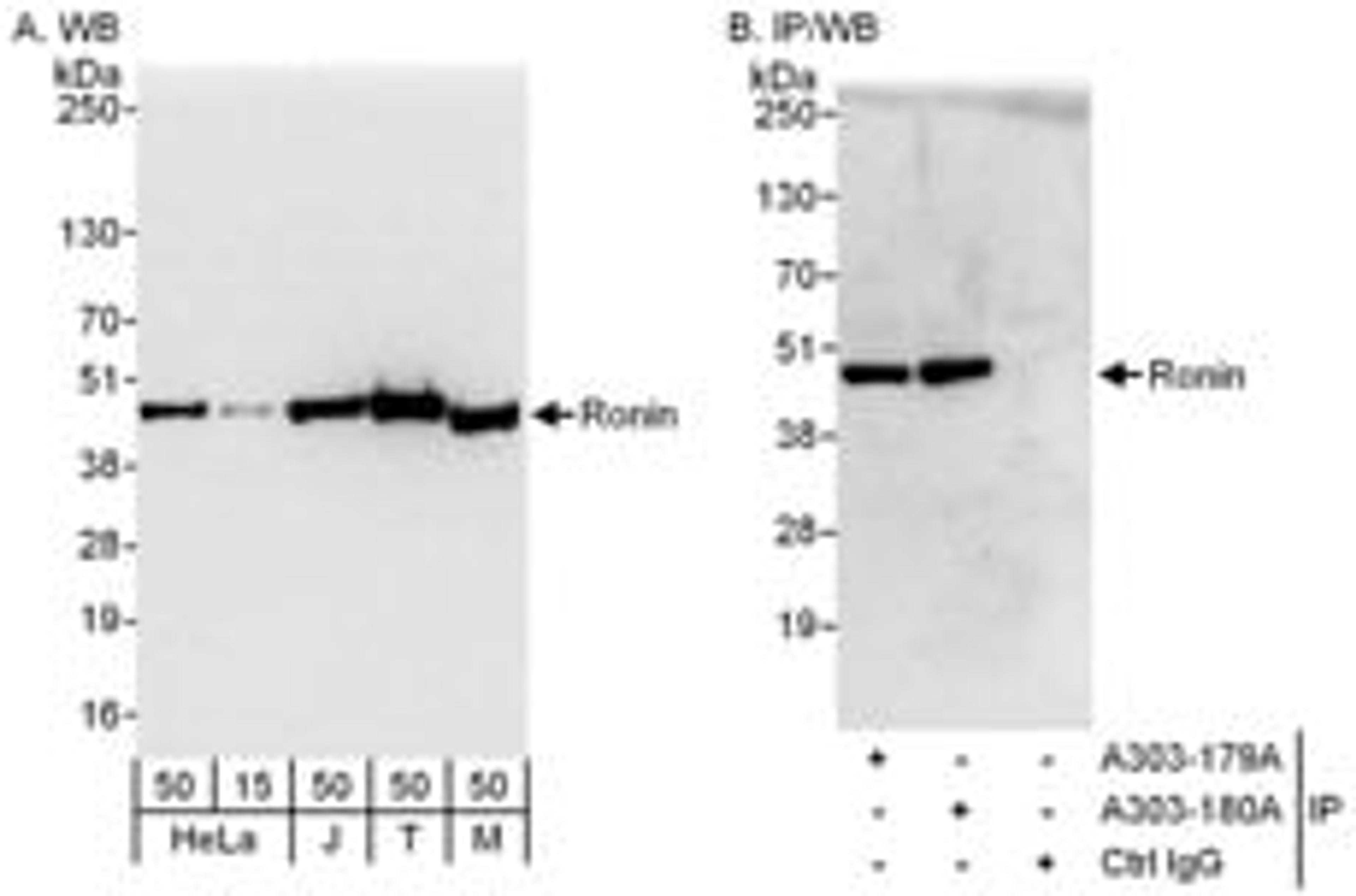 Detection of human and mouse Ronin by western blot (h and m) and immunoprecipitation (h).