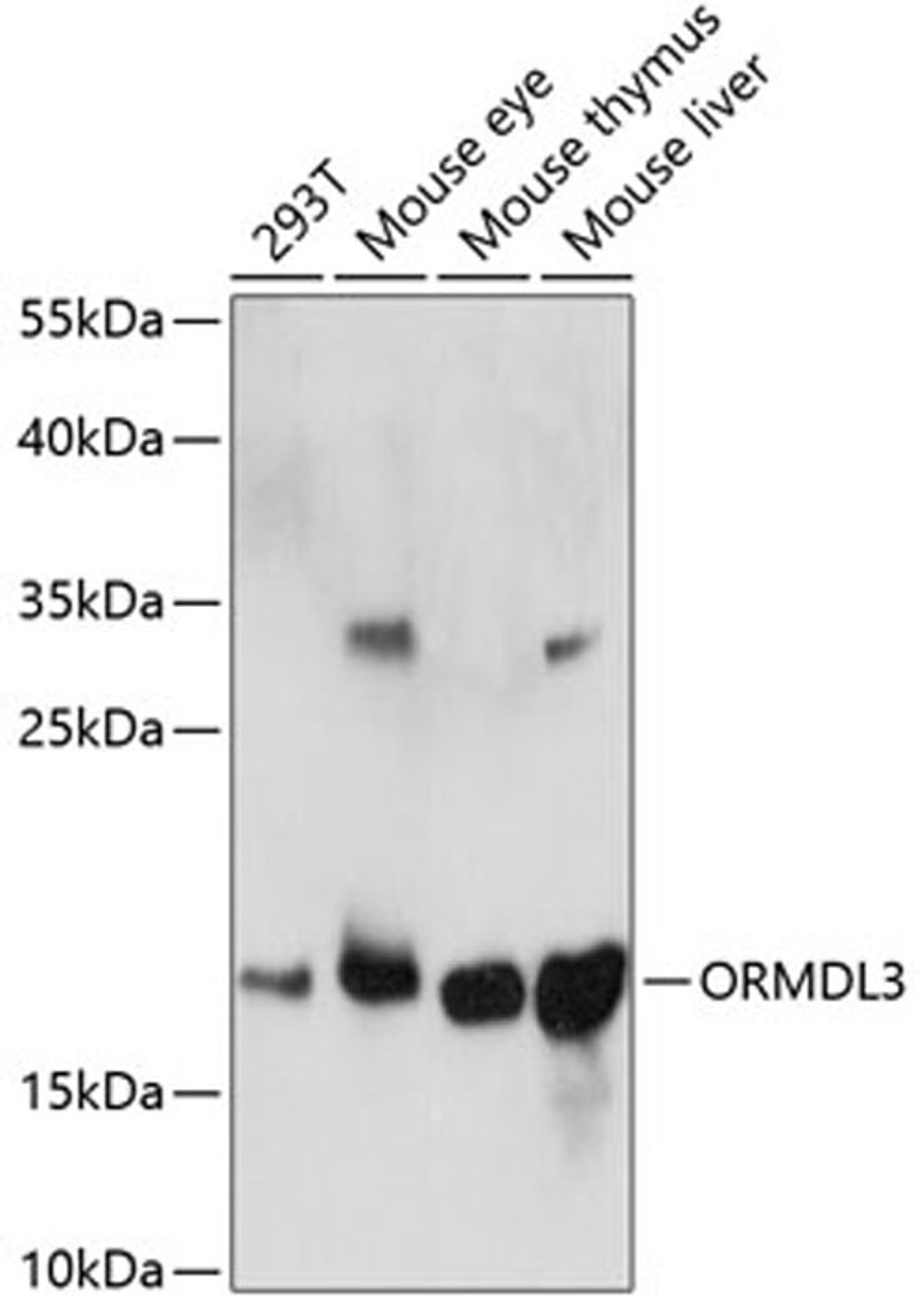 Western blot - ORMDL3 antibody (A14951)