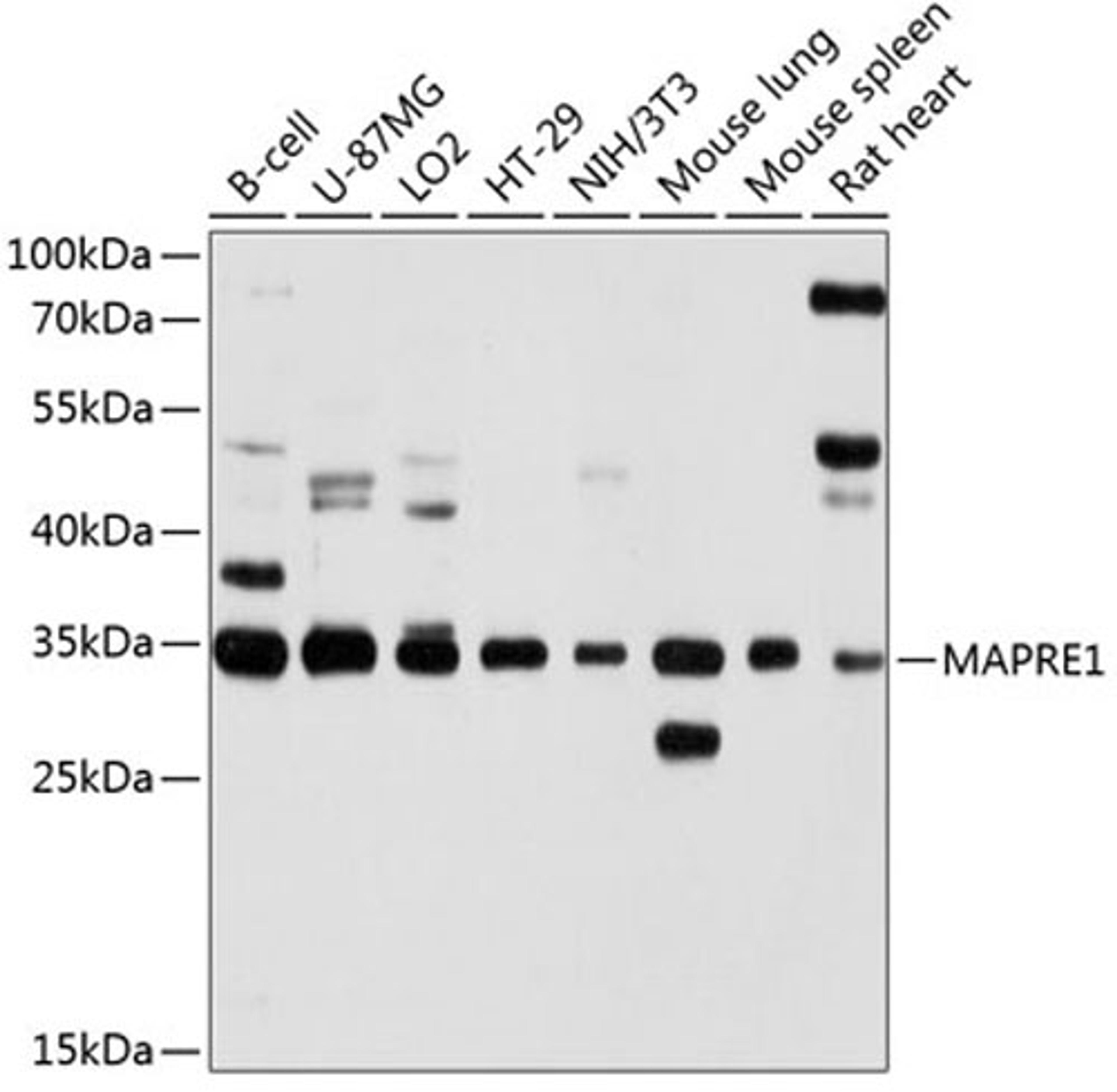 Western blot - MAPRE1 antibody (A2614)