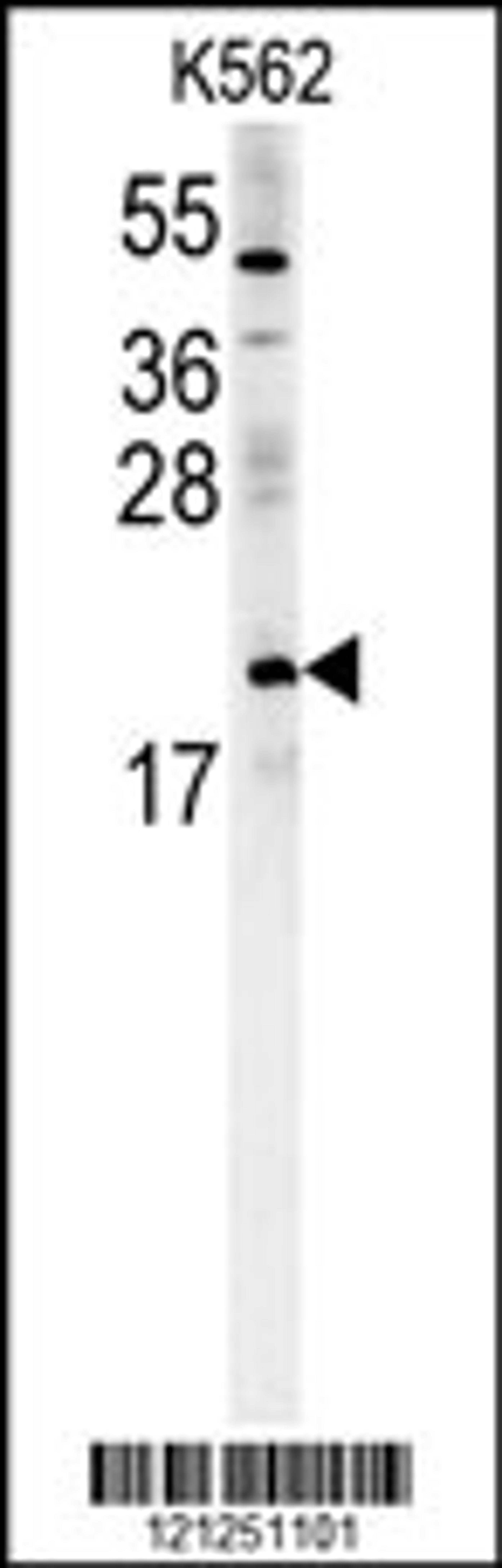 Western blot analysis in K562 cell line lysates (15ug/lane).