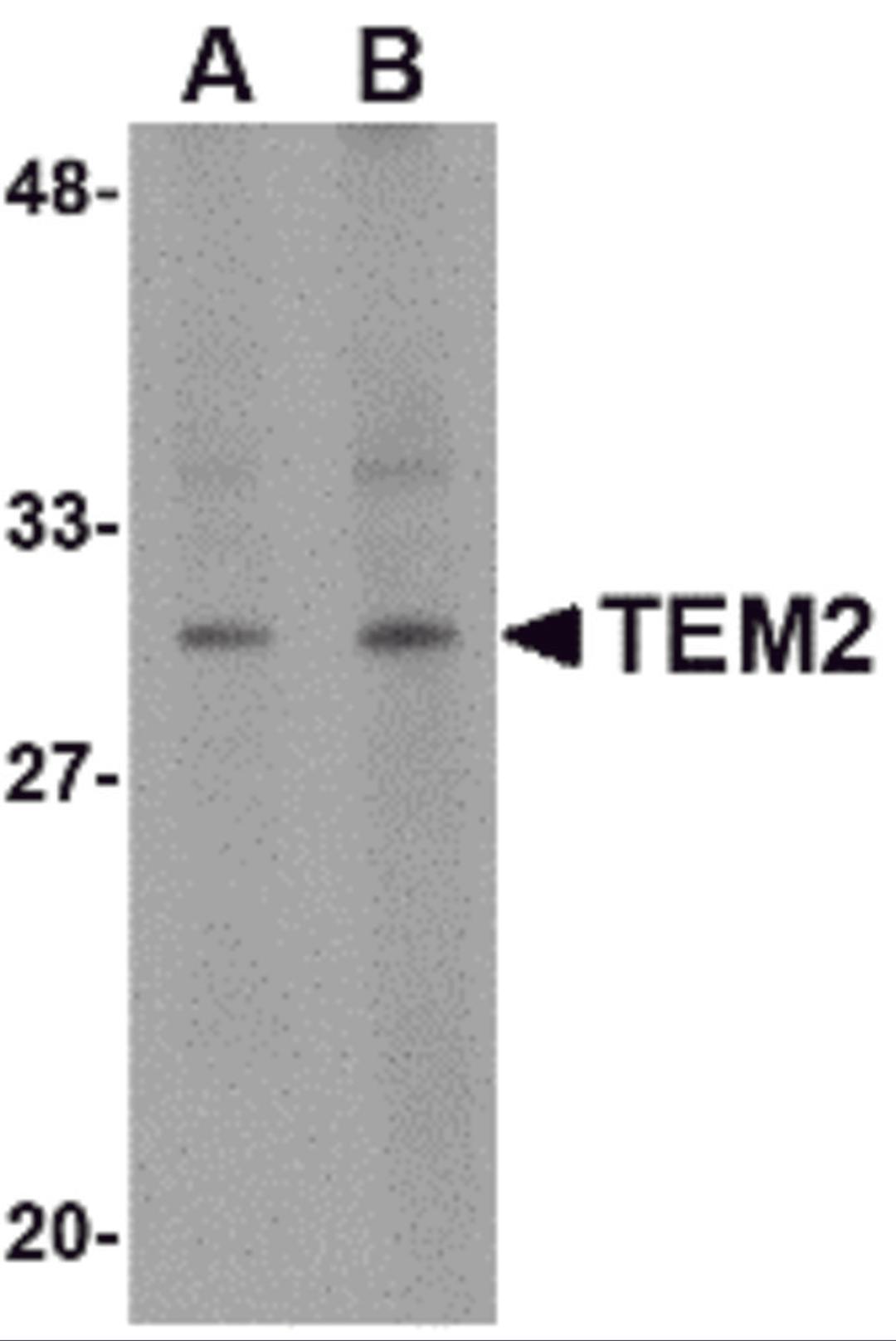 Western blot analysis of TEM2 in human colon tissue lysate with TEM2 antibody at (A) 1 and (B) 2 μg/mL.
