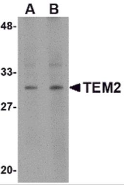 Western blot analysis of TEM2 in human colon tissue lysate with TEM2 antibody at (A) 1 and (B) 2 μg/mL.