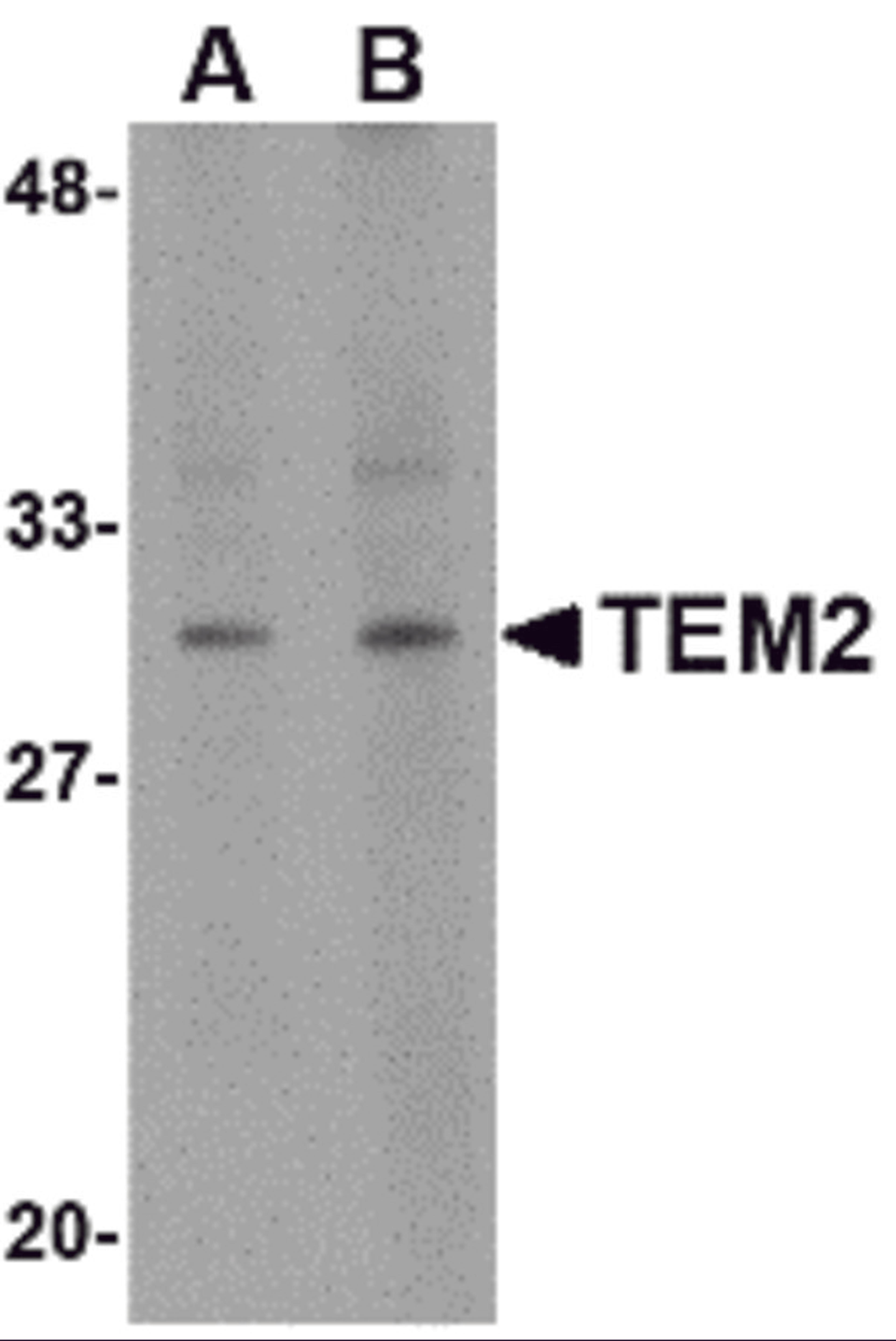 Western blot analysis of TEM2 in human colon tissue lysate with TEM2 antibody at (A) 1 and (B) 2 μg/mL.