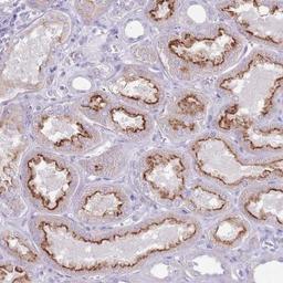 Immunohistochemistry: RSPH10B Antibody [NBP2-46740] - Analysis of human kidney shows strong luminal membranous positivity in renal tubules.