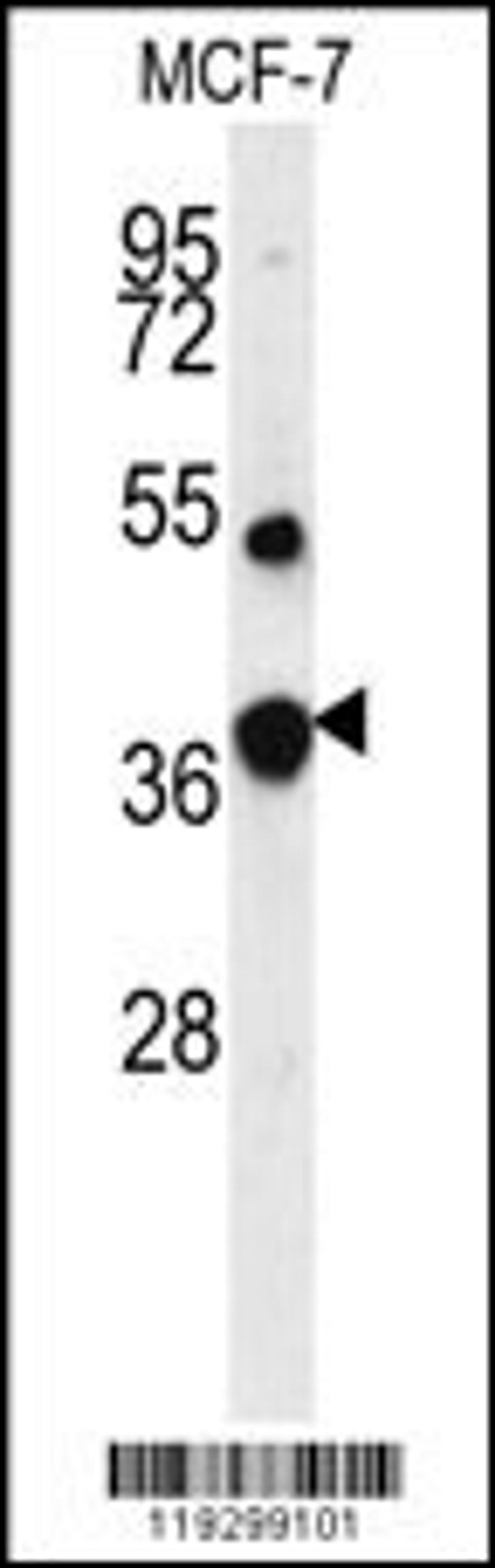 Western blot analysis of FBP1 Antibody in MCF-7 cell line lysates (35ug/lane)