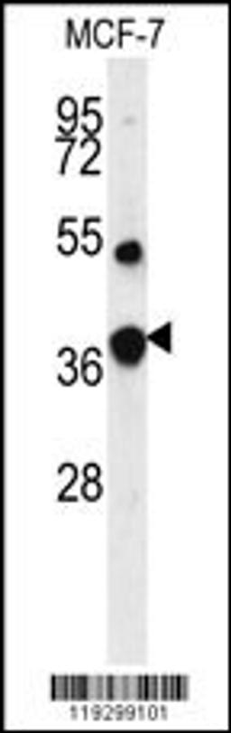 Western blot analysis of FBP1 Antibody in MCF-7 cell line lysates (35ug/lane)