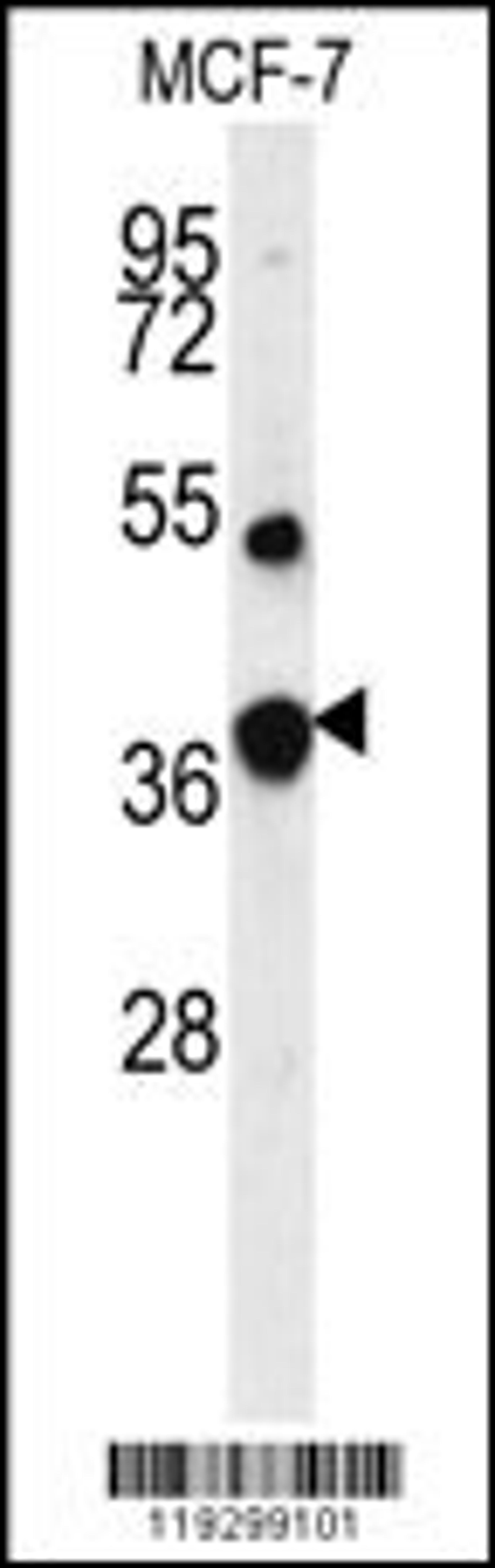 Western blot analysis of FBP1 Antibody in MCF-7 cell line lysates (35ug/lane)