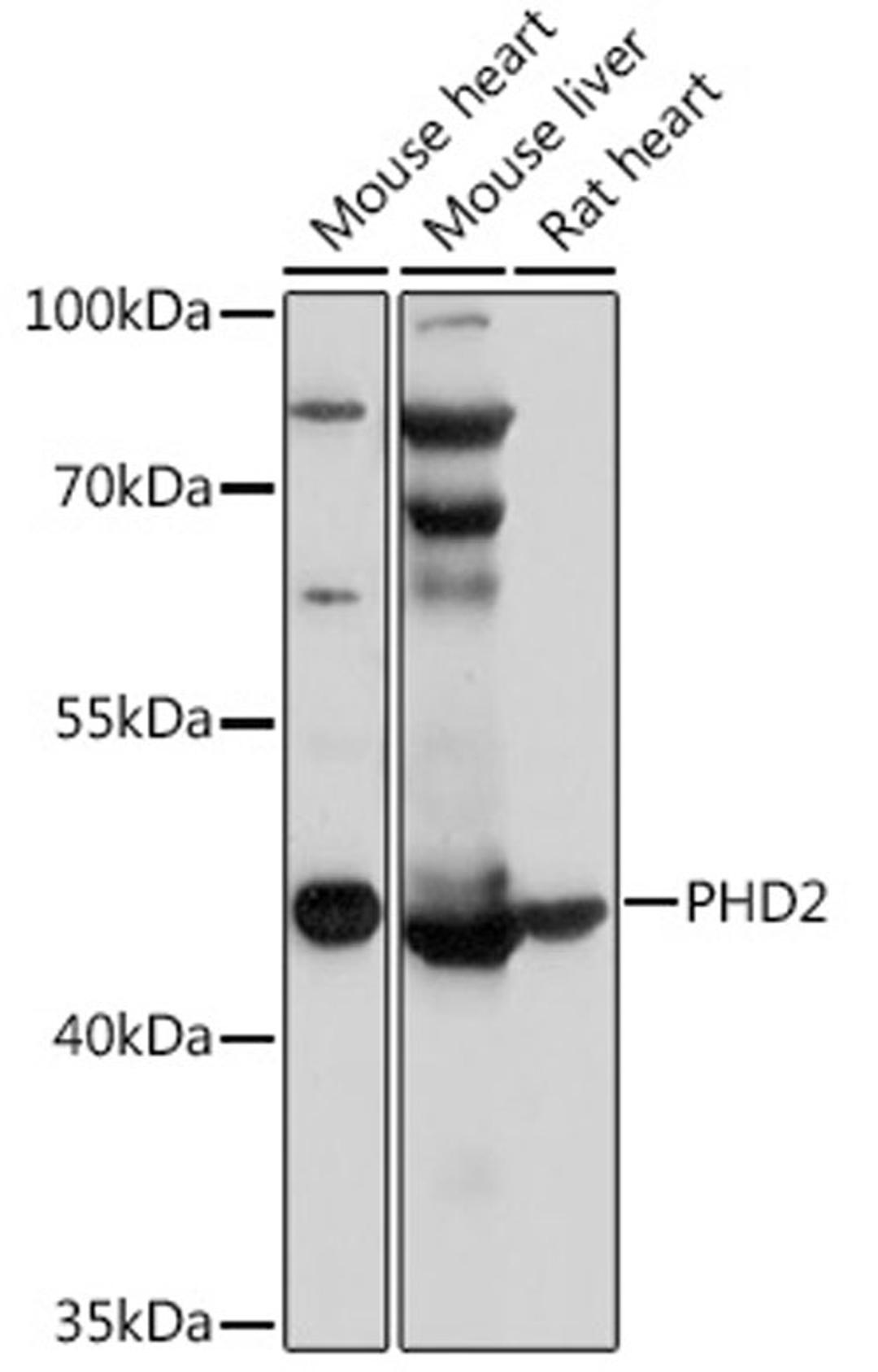 Western blot - PHD2 antibody (A14557)