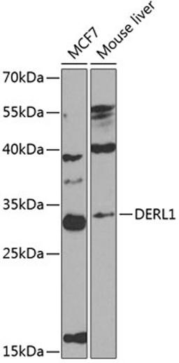 Western blot - DERL1 antibody (A8508)