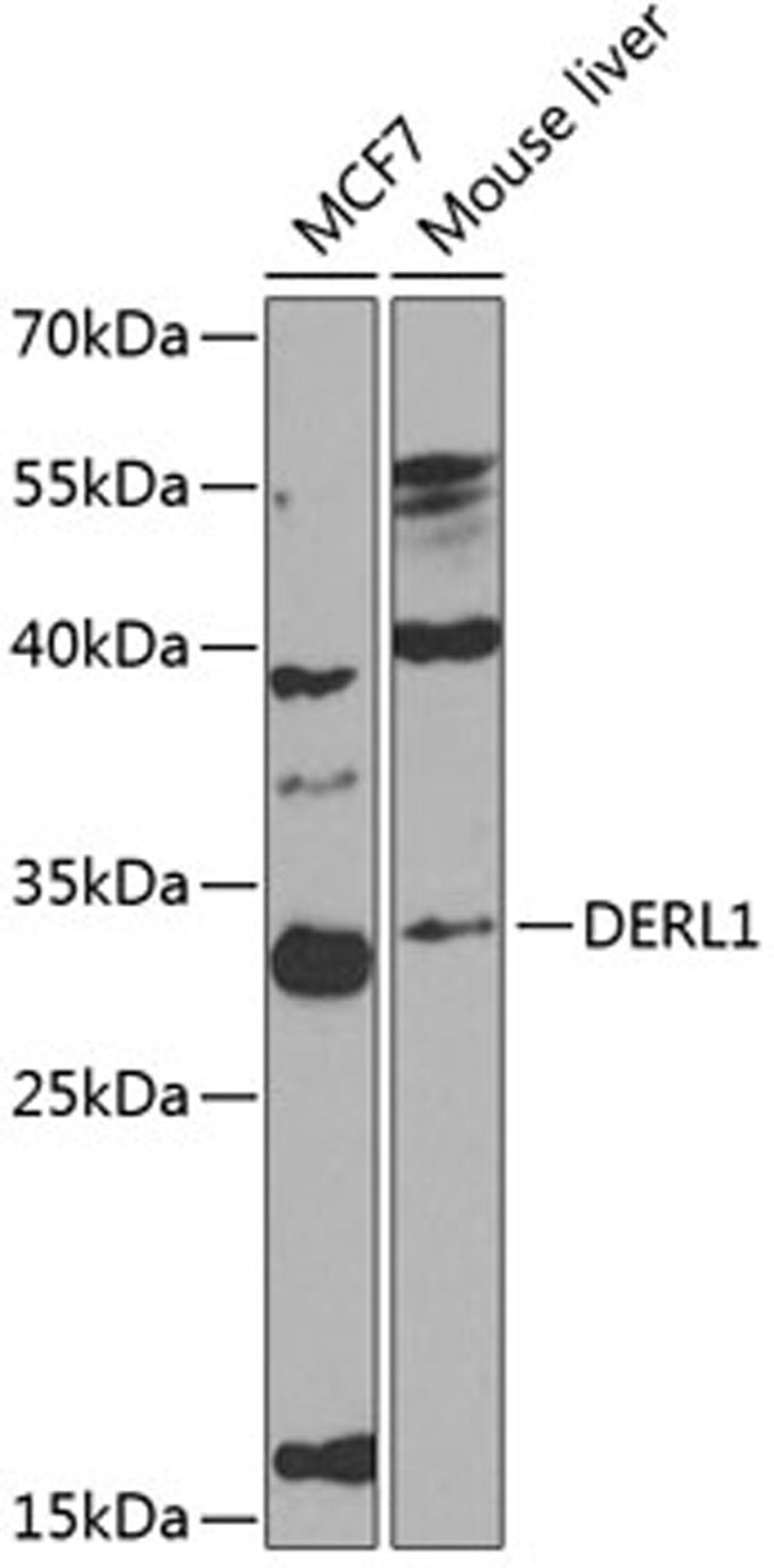 Western blot - DERL1 antibody (A8508)