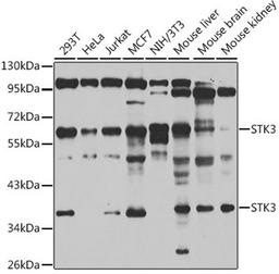 Western blot - STK3 antibody (A6992)