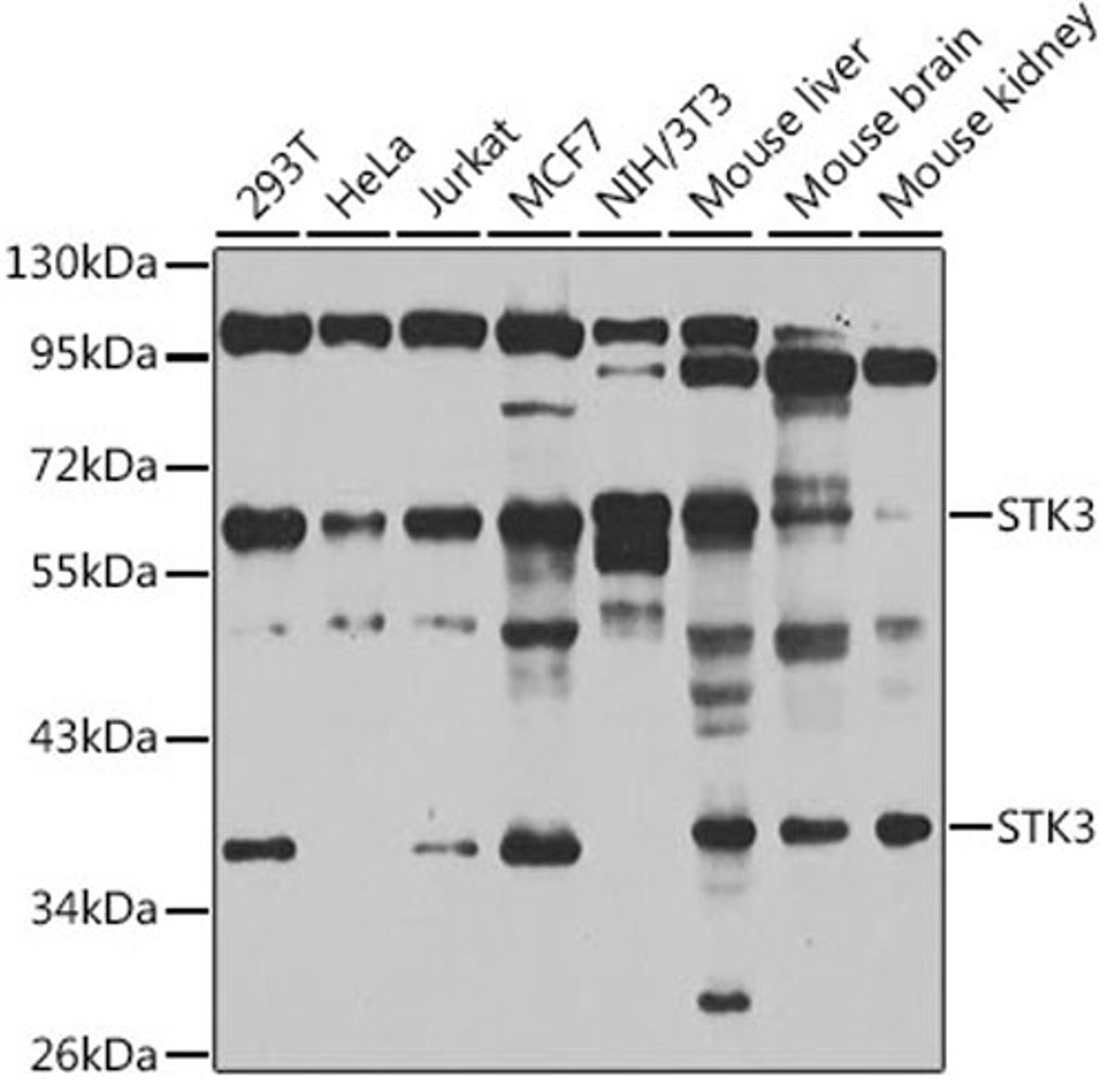 Western blot - STK3 antibody (A6992)