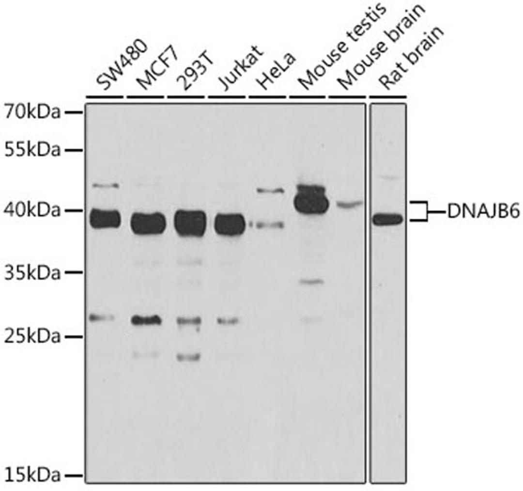 Western blot - DNAJB6 antibody (A7052)