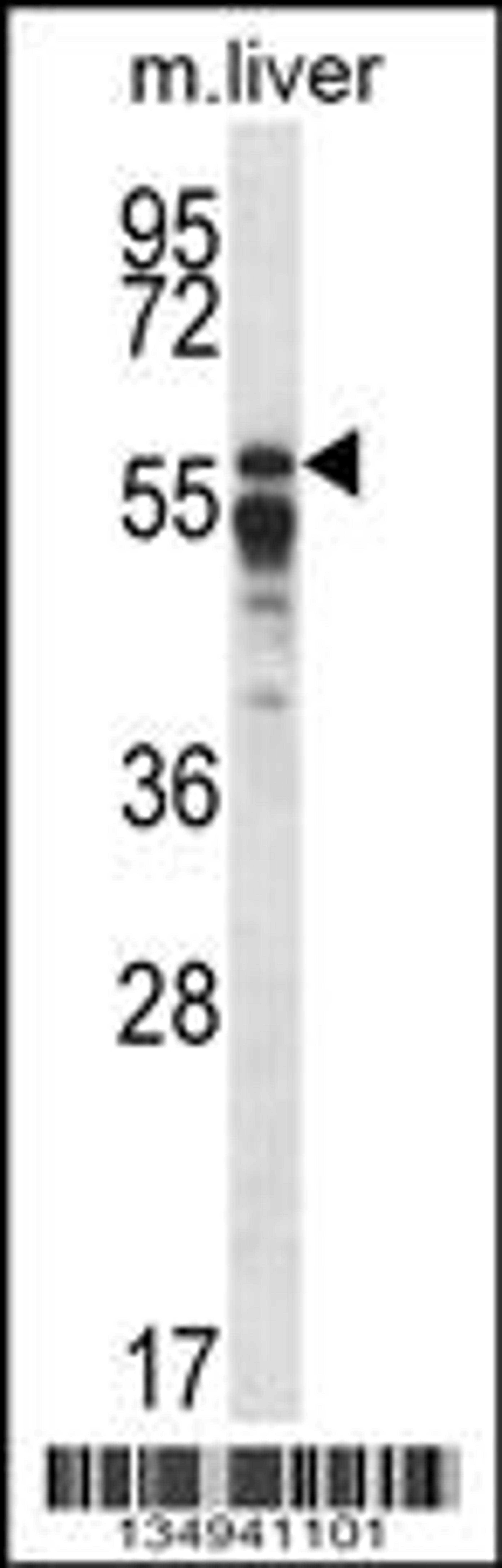 Western blot analysis in mouse liver tissue lysates (35ug/lane).