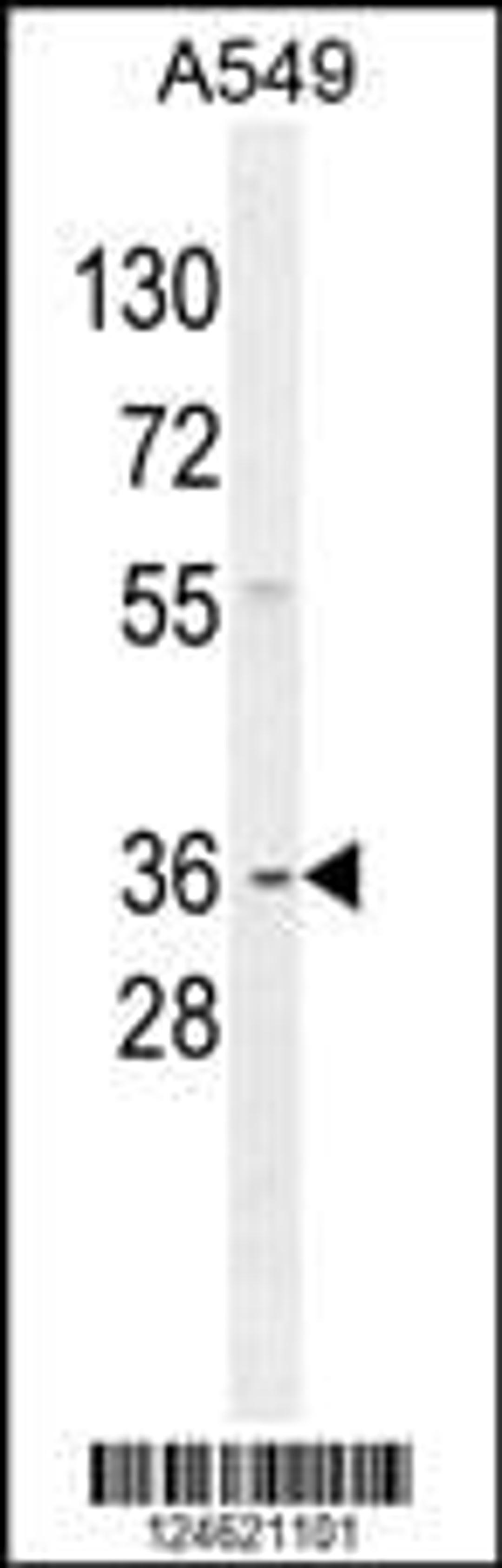 Western blot analysis in A549 cell line lysates (35ug/lane).