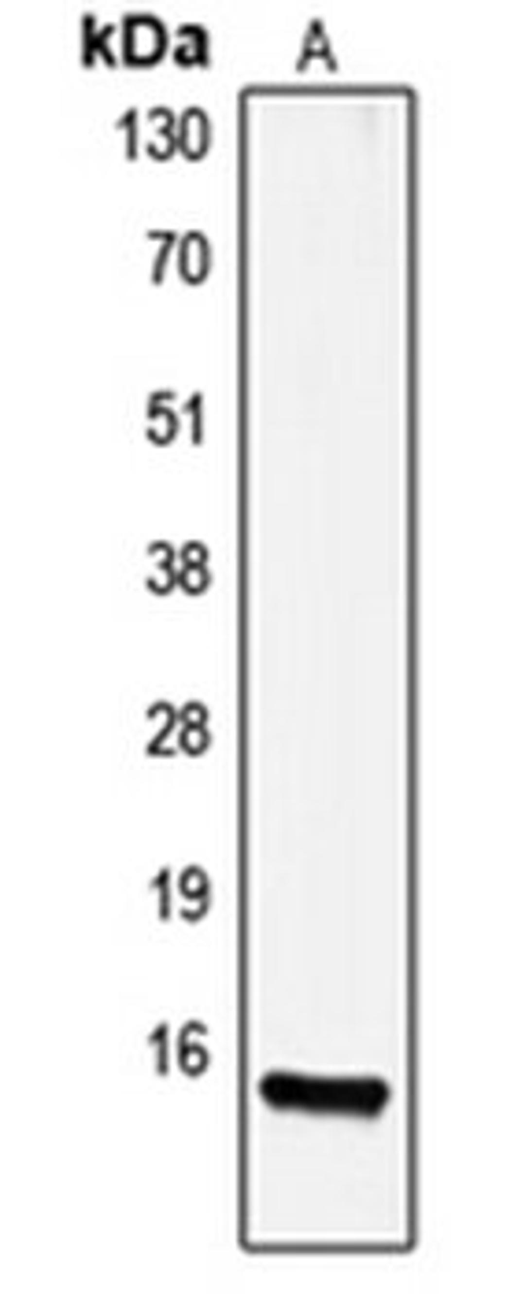 Western blot analysis of HeLa (Lane 1) whole cell lysates using GAST antibody