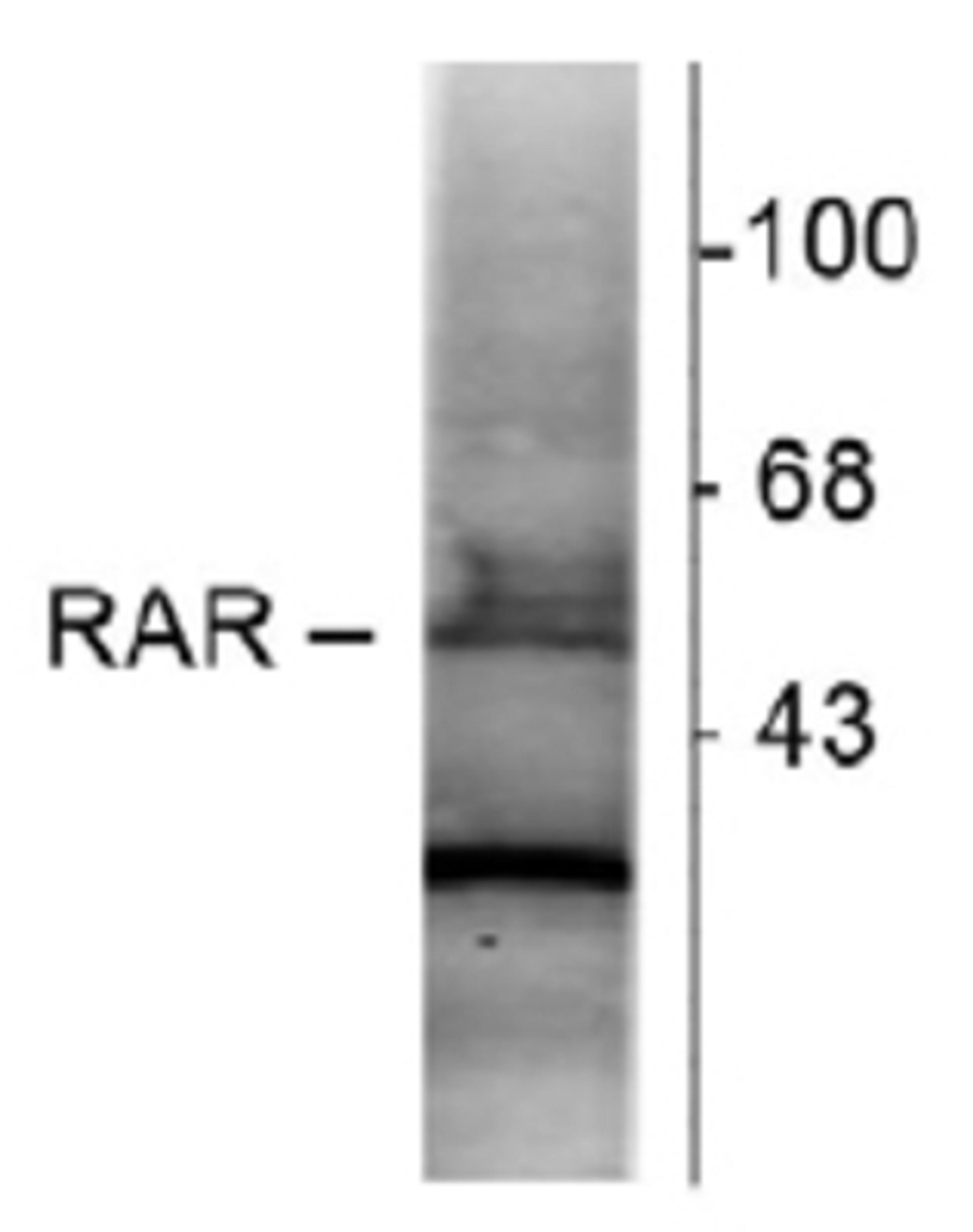 Western Blot: Retinoic Acid Receptor alpha Antibody (763) [NB200-322] - Analysis of hippocampal lysate showing specific immunolabeling of the ~48k RAR-a protein.