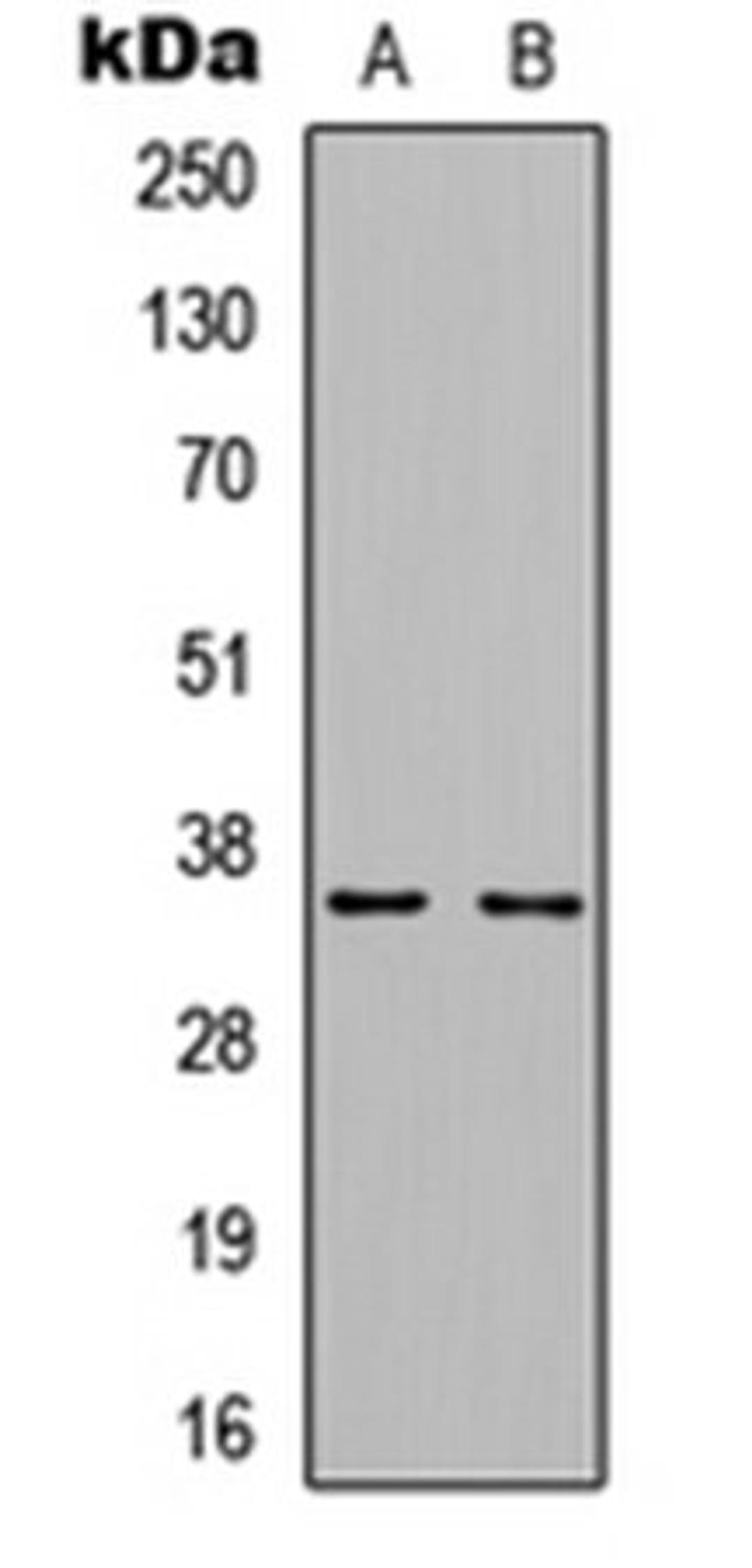 Western blot analysis of MCF7 EGF-treated (Lane 1), rat muscle (Lane 2) whole cell lysates using Cyclin D1 (phospho-T286) antibody