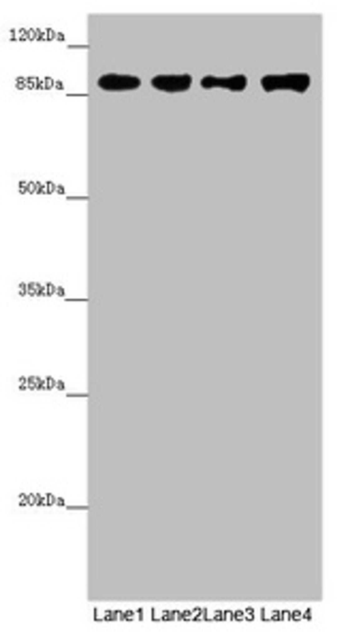 Western blot. All lanes: COG4 antibody at 4.85µg/ml. Lane 1: Mouse liver tissue. Lane 2: Mouse gonadal tissue. Lane 3: K562 whole cell lysate. Lane 4: Hela whole cell lysate. Secondary. Goat polyclonal to rabbit IgG at 1/10000 dilution. Predicted band size: 90, 39, 82 kDa. Observed band size: 90 kDa
