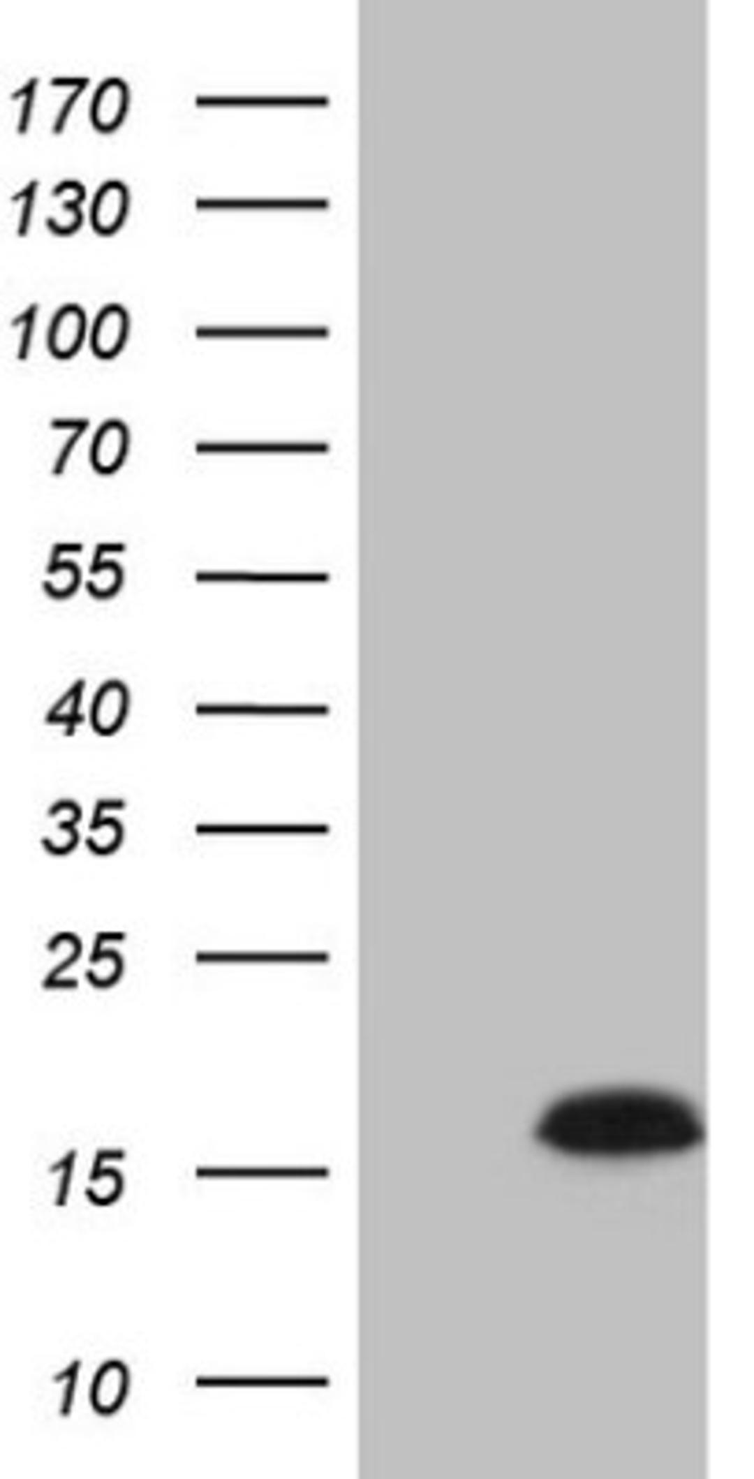 Western Blot: BNP Antibody (11G4) [NBP2-46201] - Analysis of HEK293T cells were transfected with the pCMV6-ENTRY control (Left lane) or pCMV6-ENTRY BNP.