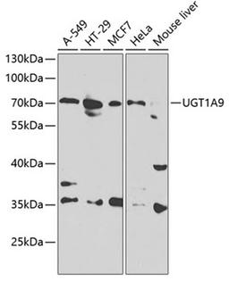 Western blot - UGT1A9 antibody (A1661)