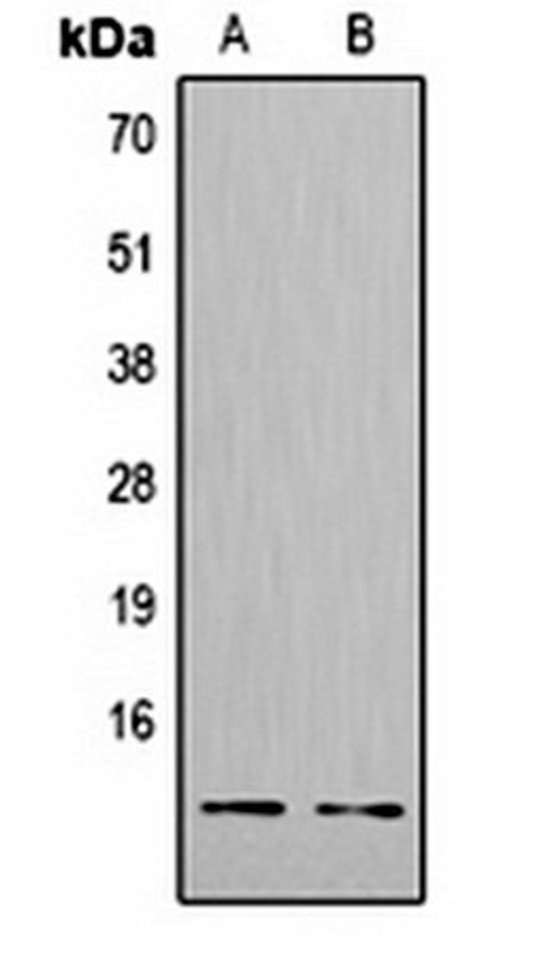 Western blot analysis of  Hela (Lane1), NIH3T3 (Lane2) whole cell lysates using Histone H4 (TriMethyl K20) antibody