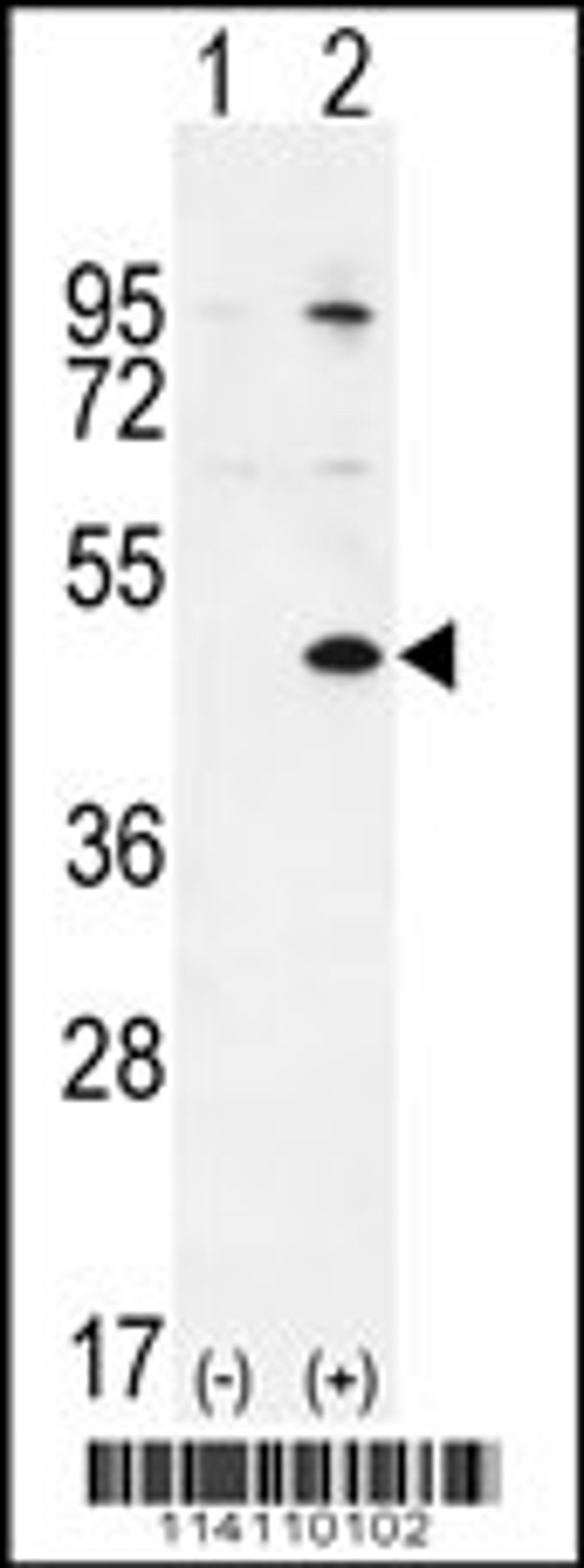 Western blot analysis of TGIF1 using rabbit polyclonal using 293 cell lysates (2 ug/lane) either nontransfected (Lane 1) or transiently transfected (Lane 2) with the TGIF1 gene.