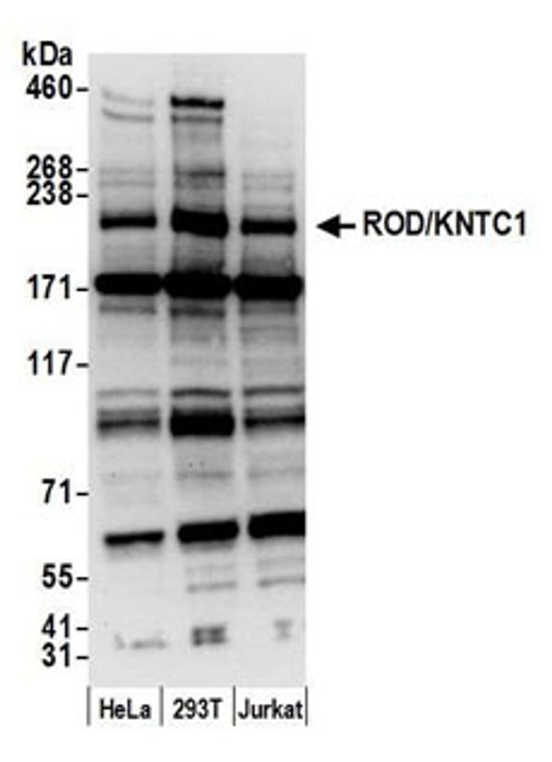 Detection of human ROD/KNTC1 by western blot.