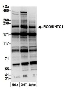 Detection of human ROD/KNTC1 by western blot.