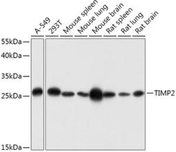 Western blot - TIMP2 antibody (A1558)