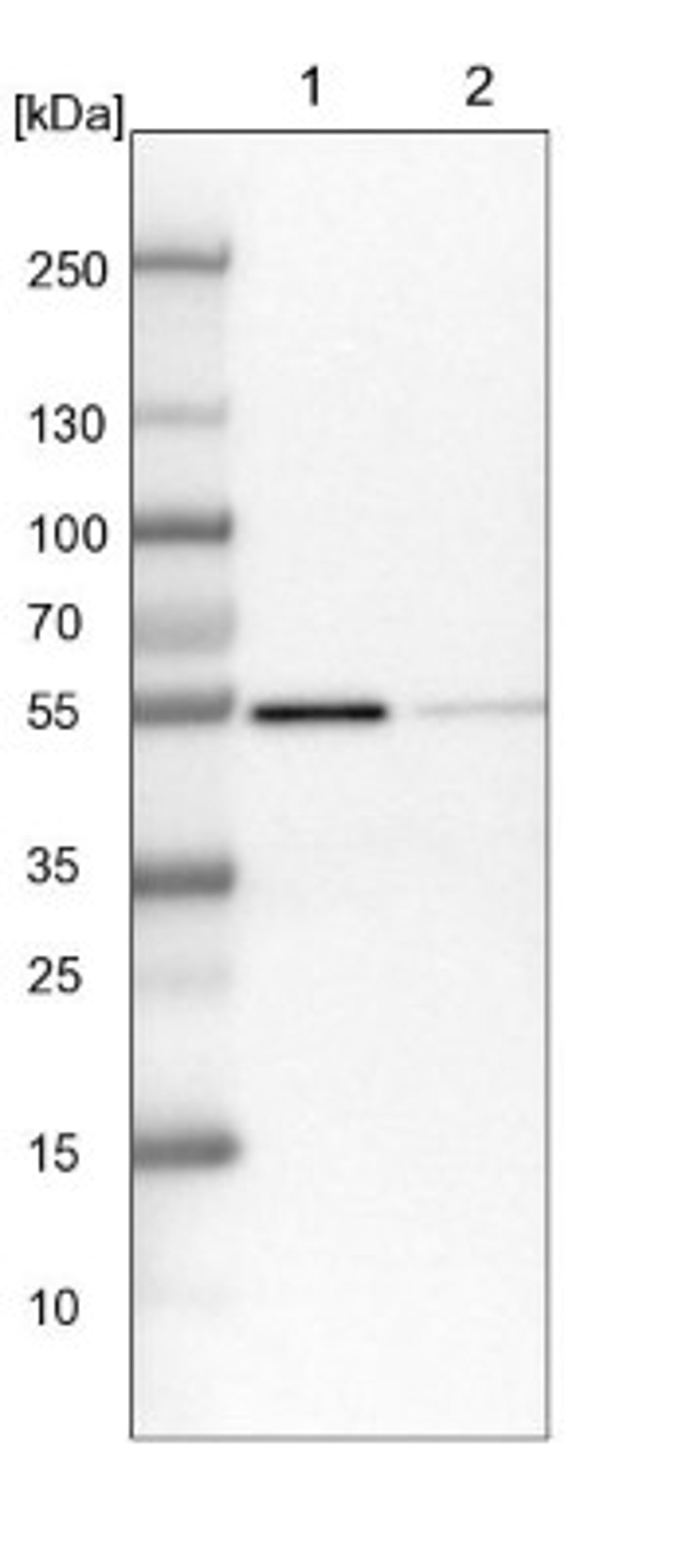 Western Blot: ABRO Antibody [NBP1-90282] - Lane 1: NIH-3T3 cell lysate (Mouse embryonic fibroblast cells)<br/>Lane 2: NBT-II cell lysate (Rat Wistar bladder tumour cells)