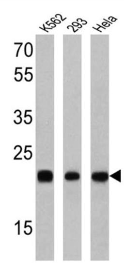 Western Blot: RAB9A Antibody (Mab9) [NB300-621] - Analysis of 25 ug of K562 (lane 1), 293 (lane 2) and Hela (lane 3).