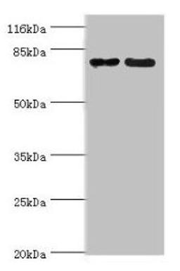 Western blot. All lanes: MTRR antibody at 2ug/ml. Lane 1: PC-3 whole cell lysate. Lane 2: HepG2 whole cell lysate. Secondary. Goat polyclonal to rabbit IgG at 1/10000 dilution. Predicted band size: 81, 78, 7 kDa. Observed band size: 81 kDa. 