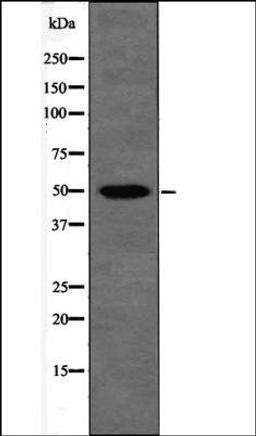 Western blot analysis of UV treated NIH-3T3 whole cell lysates using Presenilin 2 -Phospho-Ser330- antibody