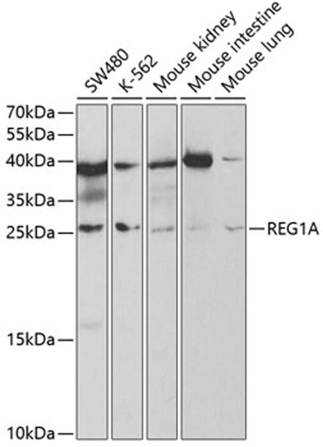 Western blot - REG1A antibody (A5327)