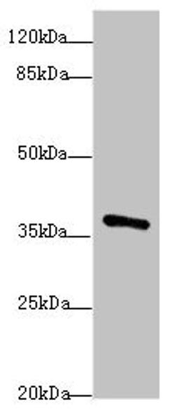 Western blot. All lanes: POU4F3antibody at 1.97ug/ml + Mouse brain tissue. Secondary. Goat polyclonal to rabbit IgG at 1/10000 dilution. Predicted band size: 37 kDa. Observed band size: 37 kDa. 
