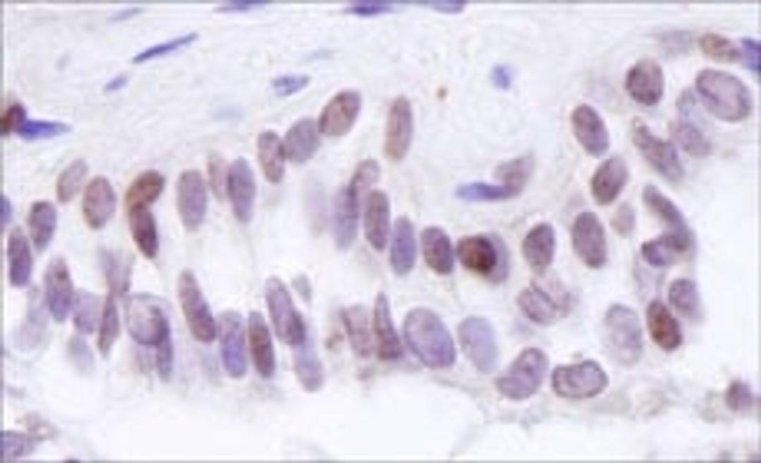 Detection of human BRD8 by immunohistochemistry.