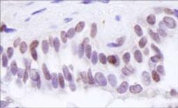 Detection of human BRD8 by immunohistochemistry.